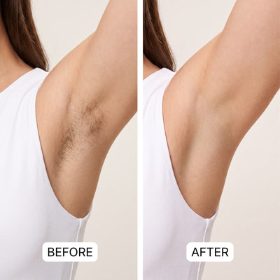 Dual Head Trimmer™ | Your Smooth Skin Solution