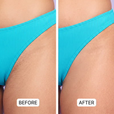 Dual Head Trimmer™ | Your Smooth Skin Solution