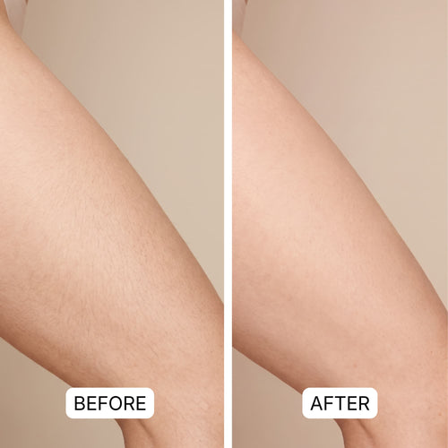 Dual Head Trimmer™ | Your Smooth Skin Solution