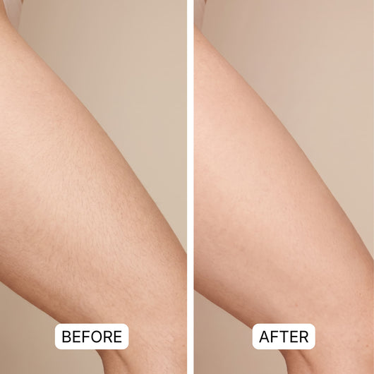 Dual Head Trimmer™ | Your Smooth Skin Solution