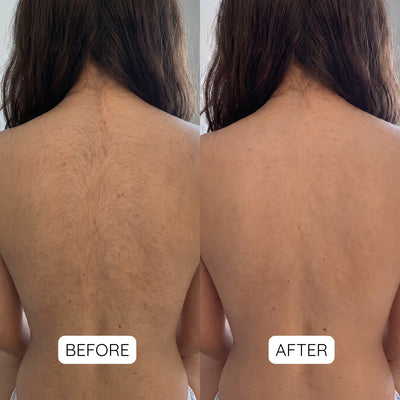 Dual Head Trimmer™ | Your Solution for Random, Fast-Growing Hair